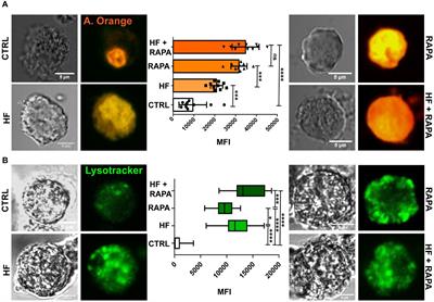 Hydatid fluid from Echinococcus granulosus induces autophagy in dendritic cells and promotes polyfunctional T-cell responses
